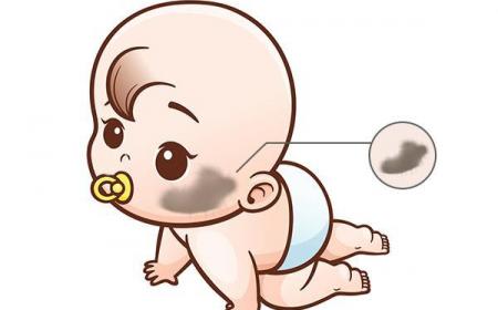婴儿的胎记是怎么形成的(婴儿各种胎记是咋形成的)
