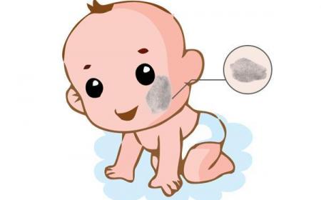 胎记是如何形成的(诱发胎记形成的因素有哪些胎儿胎记是如何形成的)