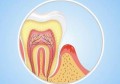 牙膏会导致牙龈出血吗(用的牙膏不好会不会牙龈出血)