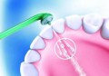 洗牙粉容易导致牙齿干燥(戴牙套会导致牙齿松动吗)