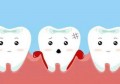 牙龈红肿的危害有什么呢(牙龈红肿会有什么后果)