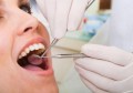 蛀牙补牙后能维持多久注意事项(蛀牙补后需要注意什么)